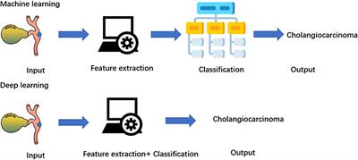 Application of AI on cholangiocarcinoma